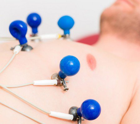 Suction cup electrodes